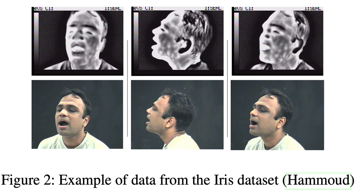 Advantages of Thermal Images over Visible Images for Facial Analysis