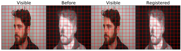 An Overview of Image Registration